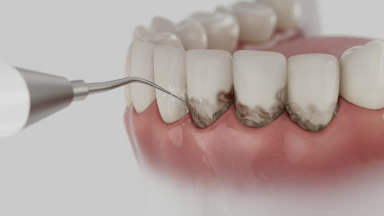 Reliable Dental contractor in Bellefontaine, OH by Dentist Open Now